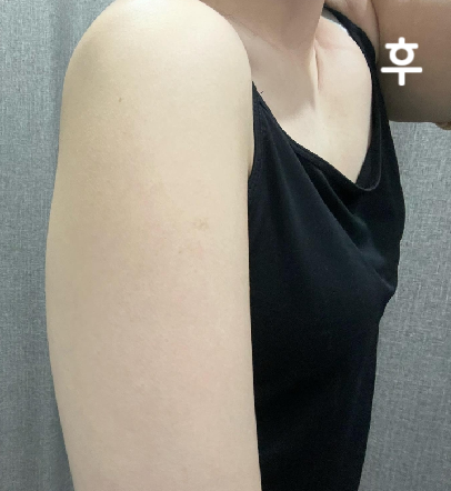 다른 곳에서 맞는 것보다 아프지 않아서 맞을 때 부담이 없어요~