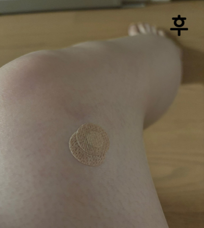 거의 안 아프고 효과 있어서 살쪘다 싶으면 맞으러 와요~