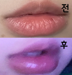 조금씩 넣어주시면서 시술 해주셔서 생각한대로 나왔어요~