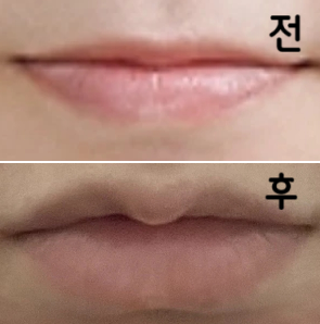 입고리가 메인인 것 같았는데 입술 전체의 볼륨이 더 효과가 있었어요!