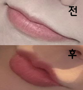 직원분들 전부 친절하시고 진짜 하나도 안 아프게 잘 해주셨어요!! 앞으로 자주 방문 할 것 같아요!! :)