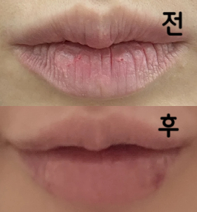 롤리팝은 언제 방문해도 정말 친절해요!!! 그만큼 손님도 많긴 해서 대기는 있지만 친절하고 담당쌤도 신경 많이 써 주시고 제가 원하는거 반영해주시려고 노력해서 좋았습니다!!