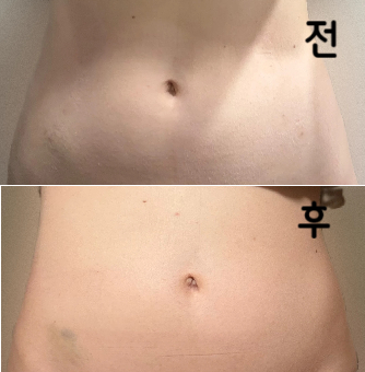 상담도 시술 중에도 매우 정중하고 아프지 않은지 확인하면서 받을 수 있었습니다!