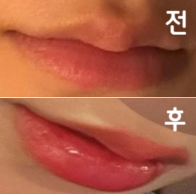 효과가 엄청 좋아용 앞으로도 자주 맞으려구요~