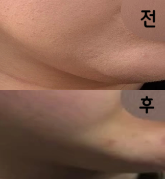 첫 회차인데 효과 있는 거 같아요!