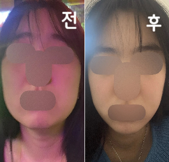 후기가 너무 좋아서 예약했는데 진짜 효과 좋아요! 가격도 저렴하고 다들 넘 친절하세요~