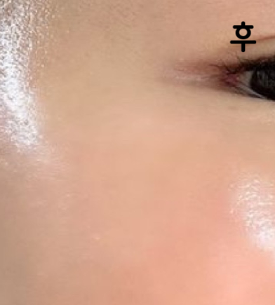 직원분도 친절하고 무엇보다 효과가 좋을 거 같아요~