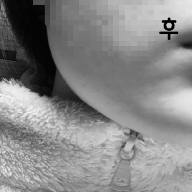 대기시간이 길긴 하지만 가성비 좋고 얼굴 선이 정리되는 느낌이라 좋아요~