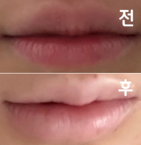 왜 이렇게 고민했었나 싶을 정도로 너무 만족스럽습니다! 여기서만 맞을거에용 ㅎㅎ