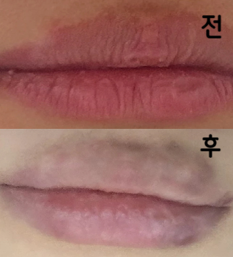 원하는 디자인 생각도 안하고 갔는데 실장님이 잘 어울릴 거 같은 스타일 추천도 해주시고 원장님도 계속 원하는거 체크해주셔서 넘 좋았어용!!