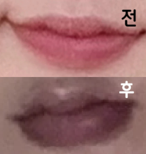 일단 상담 실장님 진짜 친절하시구 입술도 너무 맘에 들어서 두 번째에요ㅠ 여기 진자 굳인 듯~