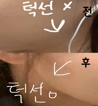 다른 병원에서도 많이 맞아봤는데 여기만큼 효과 있는 곳이 없어서 재방문 할 예정입니다!! 강추해요!!