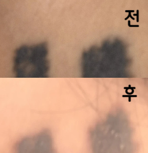 항상 친절하게 잘 받고 있어요 오늘로 3회찬데 매 번 마음 놓이게 해주시고 감사합니다~