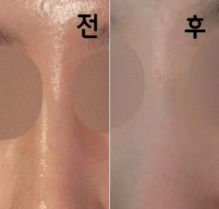 안내 받고 잘 시술했습니다! 사람 많지만 신경 잘 써주십니다!