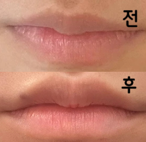 웃을 때 입꼬리를 내리는 습관이 있는데 웃을 때 입꼬리가 올라감 진짜 너무 이쁨~