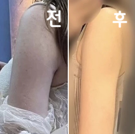 가늘어지고 있다! 라고 효과를 느꼈습니다!