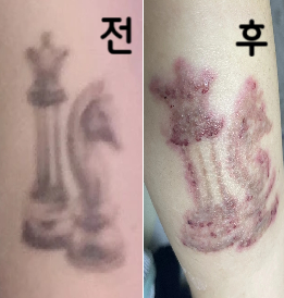 많이 옅어지고 있어서 좋아요 추천해요~!