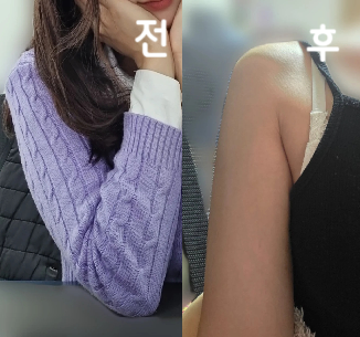 대기자 중 일본인분들도 많았고 사람이 많아서 유명한 곳 잘 왔구나 싶었어요~  잘은 모르겠는데 좀 빠진 것 같아서 2주 간격으로 3번 맞아보려구요!