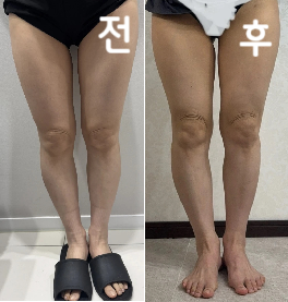 체중은 줄지 않았지만 왠지 모르게 다리가 마른 느낌이 듭니다. 개인적으로 다리가 마른 적이 없었기 때문에 대만족입니다!