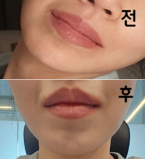 만족해요 한 번 더 받으러 갈게용 ♥