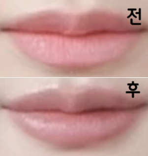 모양도 맘에 들고 원하는 모양으로 최대한 맞춰서 시술 해 주십니당~