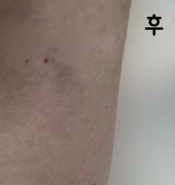 동일한 가격과 추가 권유 같은 것이 없어서 좋았습니다!