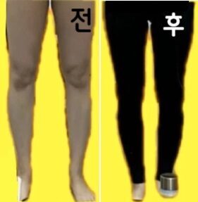 다이어트와 병행하고 있던 것도 있습니다만, 그로부터 2주 후 피크로 한 층 다리가 가늘어졌습니다! 또 가고 싶다고 생각하고 있습니다!