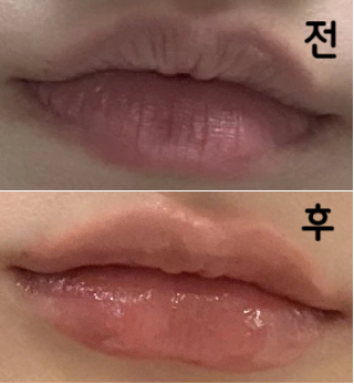 꼼꼼하게 상담해주시고, 시술 해 주셔서 좋았어요!