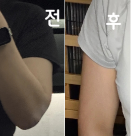 너무너무 안 아프고 용량도 더 해주시려고 하고 진짜 갈 때마다 스탭분들도 친절하셔서 맨날 오고 싶어요~~