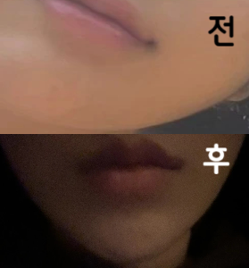 친절하셨고 병원 내부도 깔끔하고 벌써 효과가 있는 것 같아요!