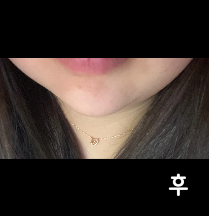 가격도 합리적이고 다들 너무 친절하세용~ 아직 1회차라서 큰 효과는 모르겠지만 꾸준히 맞으면 효과 있을 거 같아요!