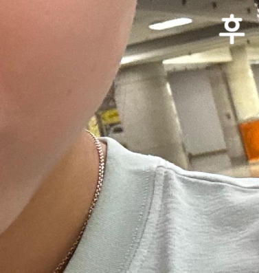 가성비도 좋고 효과 있는 윤곽주사라 주기적으로 해용~