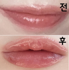 주변 사람들에게 입술 칭찬을 받아요~ 입술이 원래 얇았는데 귀여워져서 좋아요~~~
