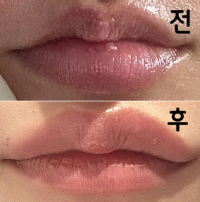 비대칭 + 말림 + 작고 얇음 + 쳐진 입꼬리 환장 콜라보인데 너무 예쁘게 잘 놔주셨어요!!