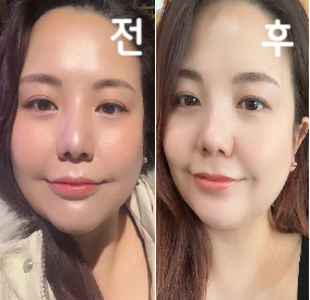 미묘하게 세수 할 때 만져지는 얼굴 크기가 달라여!