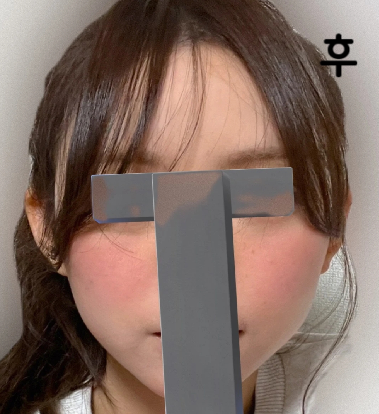 매우 인기 있는 클리닉으로 선생님도 실장님도 매우 친절했습니다!