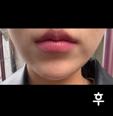 실장님 원장님 친절하시구 좋아용 담에 또 맞을게용~