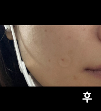 1차와 2차 사이에 약간 꺼진 부분이 차오르는게 보여요~ 3차도 기대해봅니다! 다들 친절하시고 좋아요~