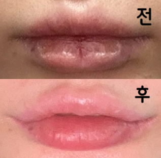 미세하게 거울로 체크를 해달라고 지시 해주시고 원하는 모양까지 조정과 선생님의 의견을 섞어 예쁘게 만들어 주었습니다!