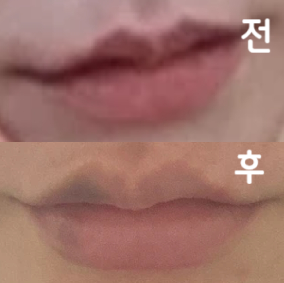 일주일 지나서 리터치 받았는데 볼륨만 살짝 더 넣으니 더 이뻐진 것 같아용~