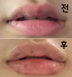 정말 친절하셨고 잘 봐주셨어요~