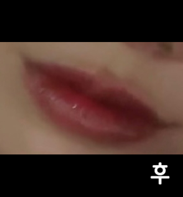 상담을 전문적으로 잘 해주세요. 과도한 시술 안 하시고, 자연스럽게 예쁘게 딱 해주시는 곳 입니다!!