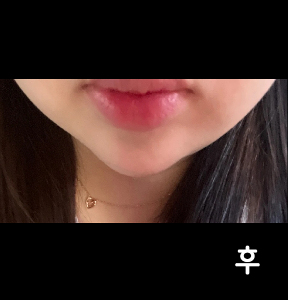 2회차인데 다들 친절하시고 꼼꼼하게 시술해주세요~