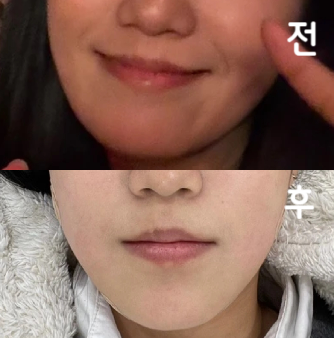 상담해주시는 분도 솔직하고 친절하게 해주시고, 제가 많이 고민할 때 결정도 잘 내려주셔서 만족스러웠어요!