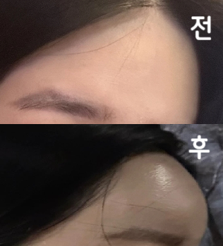 가격이 저렴했고 일단 직원 의사 상담해주시는 분 모두 다 친절하셨어요~ 결과도 만족!