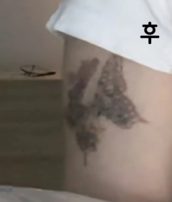 계속 잘 다니고 있고 주변에서도 다들 옅어졌다고 해요~