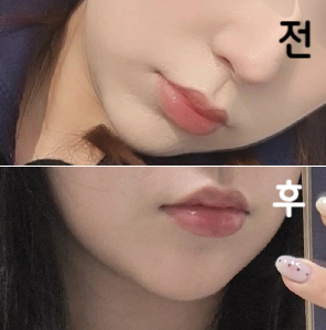 대기시간 길지 않았고 직원분들 의사쌤 친절하셨음!!