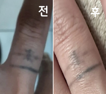 효과는 느껴지고 있기 때문에 끈기있게 다니도록 하겠습니다!