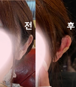 친구들도 얼굴이 더 작아 보인다고 엄청 칭찬해 줬어요!