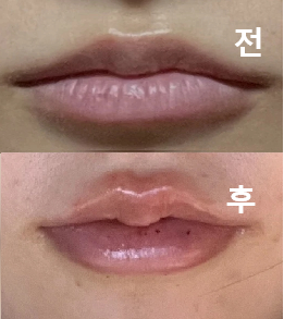 자연스럽고 티 안나게 해주셔서 만족했어요!